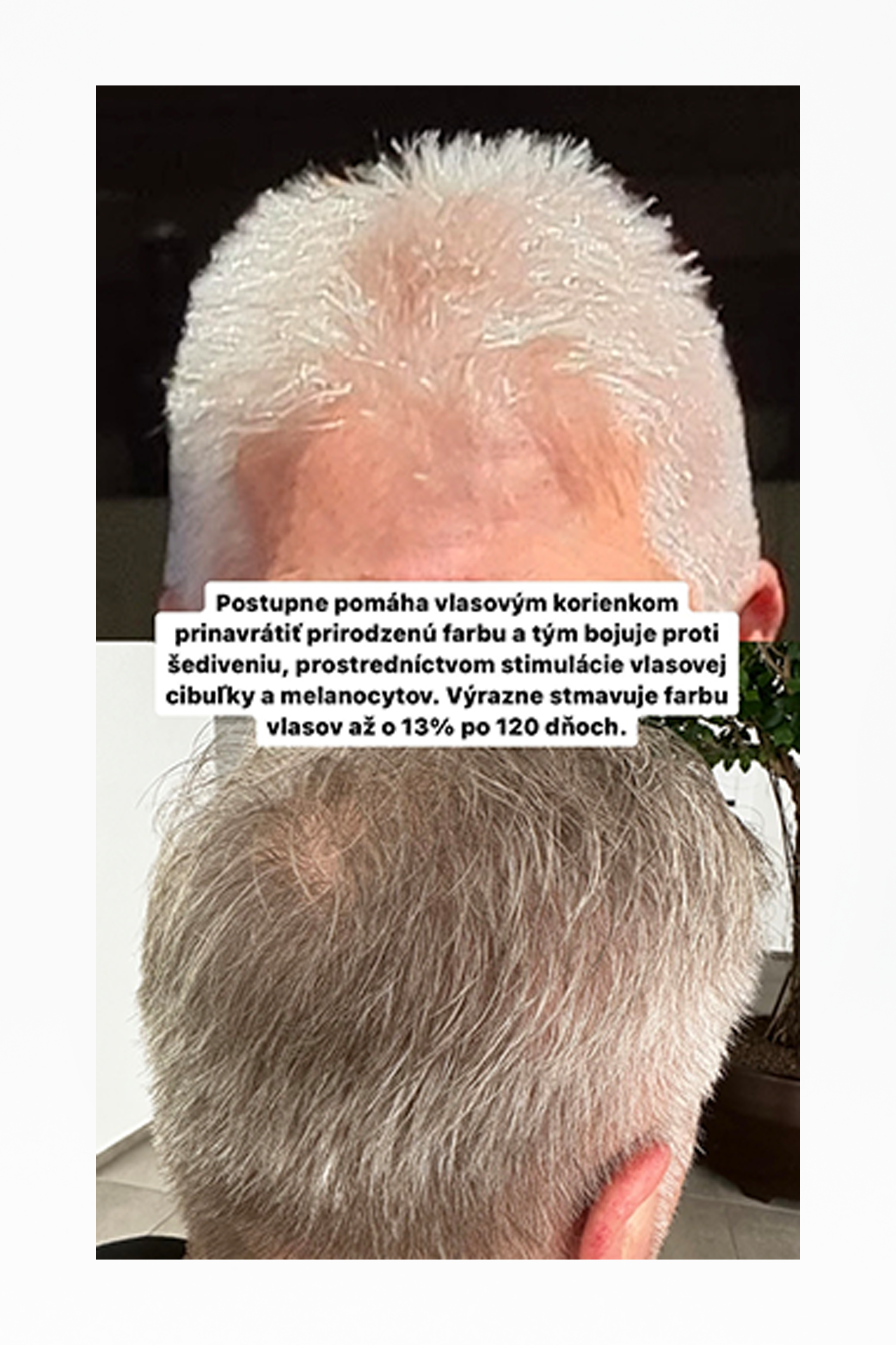 Andreine-Vitamíny proti šedivým vlasom Grey be gone